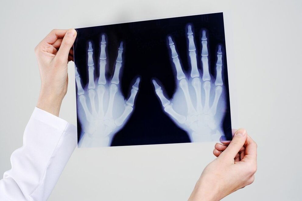 diagnostic des articulations de la main